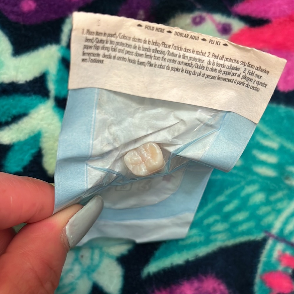 Wisdom tooth - Picture 2 of 2
